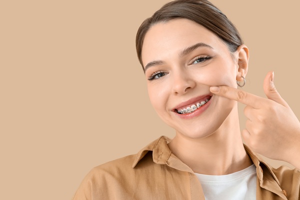 Frequently Asked Questions About Braces For Adults