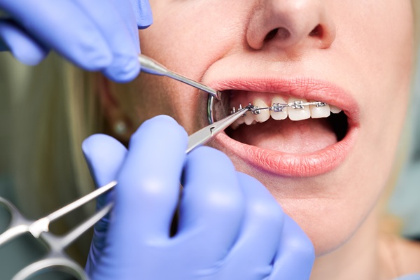 Why You Should Seek Out A Braces Specialist