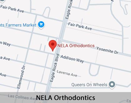 Map image for Adult Orthodontics in Los Angeles, CA